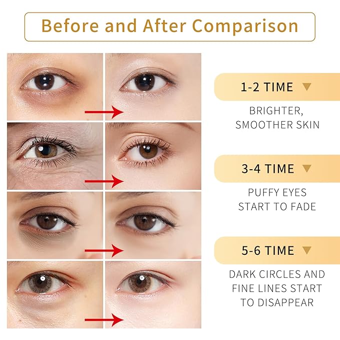 Under Eye Patches-24k Gold Eye Mask Pads - 60 Pieces, Collagen Hyaluronic Acid Eye Mask, Anti-Aging, Reduce Dark Circles, Puffiness and Wrinkles, For Men and Women