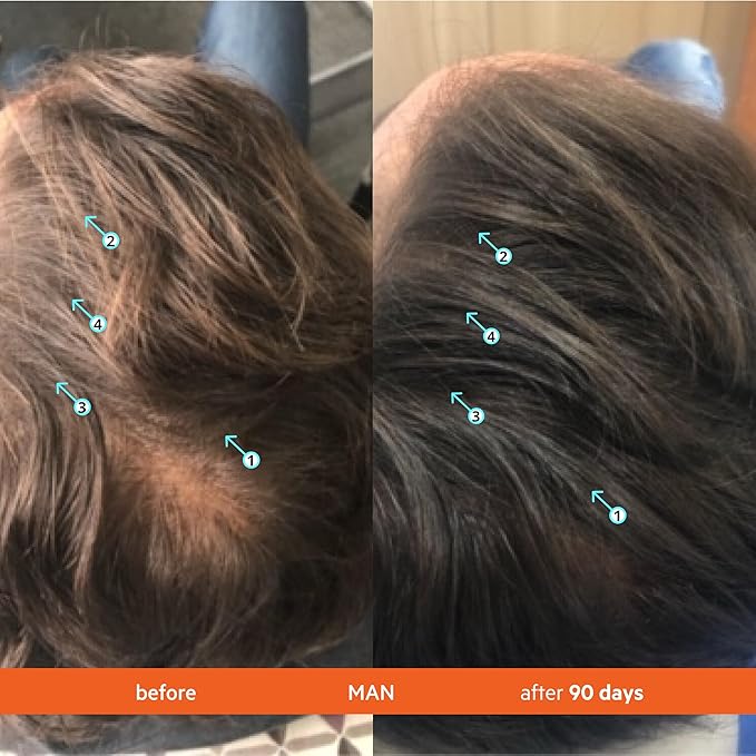 DS Labs Revita Shampoo and Conditioner – High-Performance Hair Density Kit, Volumizing, Thickening, Fuller, Sulfate & Silicone Free, For Men & Women, 925mL, Packaging May Vary