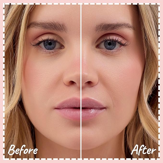 Lip Treat Balm - Hydrating & Nourishing Lip Balm with Avocado, Olive, and Coconut Oils - Smooth, Softening Lip Moisturizer & Protection for Very Dry Lips - Marshmallow Scented, 0.7oz