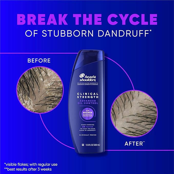 Head & Shoulders Clinical Dandruff Shampoo Twin Pack, Prescription Strength, Oil & Flake Control, Seborrheic Dermatitis Relief, Citrus, 13.5 Fl Oz Each (Set of 2)