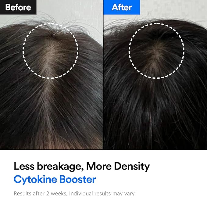 Hair-Recovery Cytokine Booster Sebum Care, 3.38 Fl.Oz.– Hair Regrowth Tonic for Thinning Hair, Oily Scalp Control, Hair Loss Treatment, Stimulates Follicles, Balances Sebum, Non-Greasy for Men & Women