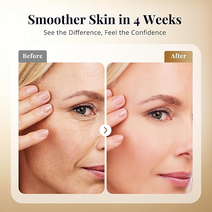 Anti Aging Serum, Retinol Serum for Face with Squalane and Hydrolyzed Collagen, Improve Fine Lines and Hydrate Skin, Wrinkle Retinol for Various Types of Skin Women/Men(1.7 Fl Oz)