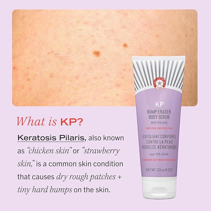 First Aid Beauty KP Bump Eraser Body Scrub Exfoliant for Keratosis Pilaris with 10% AHA – 8 oz