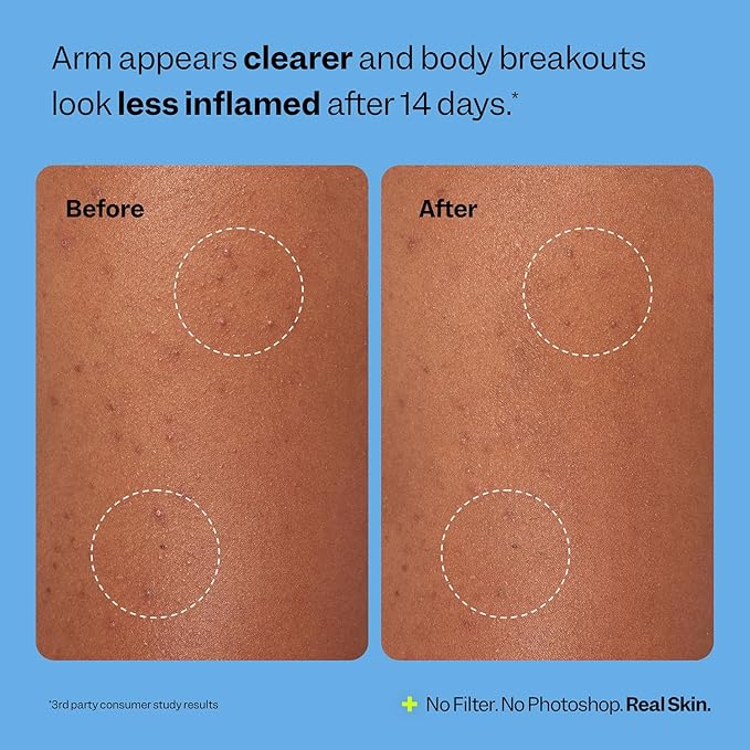 Peach Slices Body Breakout Patches