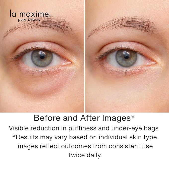 Youthful Eyes Organic Anti-Wrinkle Eye Cream, Targets Puffiness, Dark Circles, Eye bags and Fine Lines, Hydrating with Cucumber & Bilberry + 20 plant actives - Multi Award-winning formula