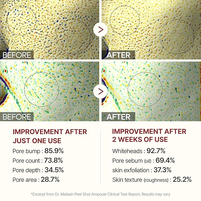 Peel Shot Glow White and Black Rice Ampoule Duo, Soft Exfoliating Face and Body Scrub Dead Skin Cells, Blackheads Remover for All Skin Types