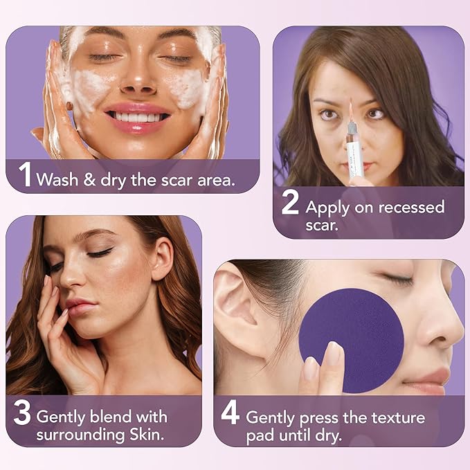 Dermaflage Scar Filler Kit - Dark - Deep Scar Cover and Waterproof Concealer for Acne Scars Wrinkles, and Ice Pick Scars Makeup, 1 mo supply