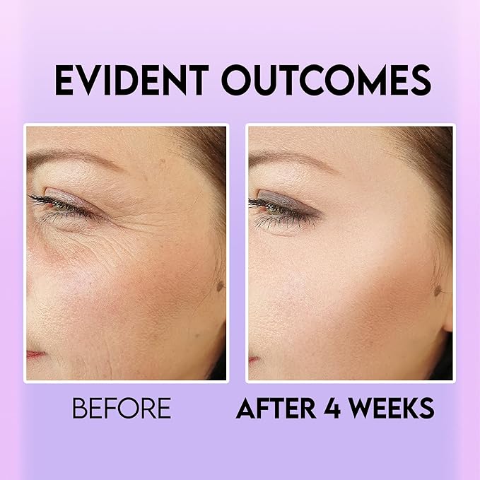 Eye Bag Remover, Under Eye Dark Circle Remover with Retinol & Caffeine, Under Eye Brightener, Anti Aging Eye Tightening Cream to Repair Wrinkles and Fine Lines