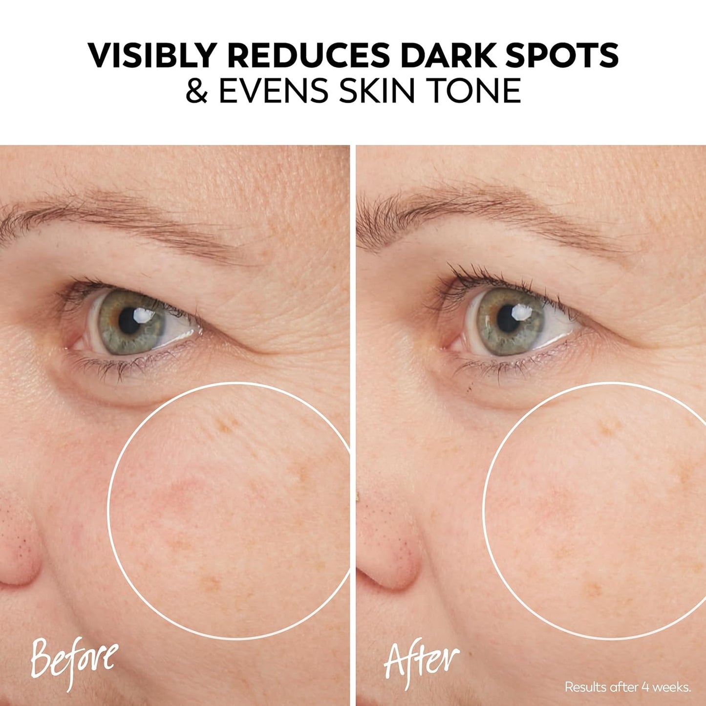 Olay Pro-X Dermatological Even Skin Tone Spot Fading Treatment Serum, 1.3 oz