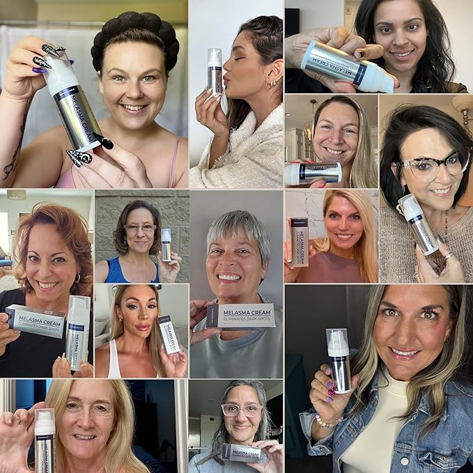 Melasma Treatment for Face - Melasma Cream & Age Spot Remover for Skin Discoloration, Post-Blemish Marks, Scars & Spots | Dark Spot Remover for Face & Body