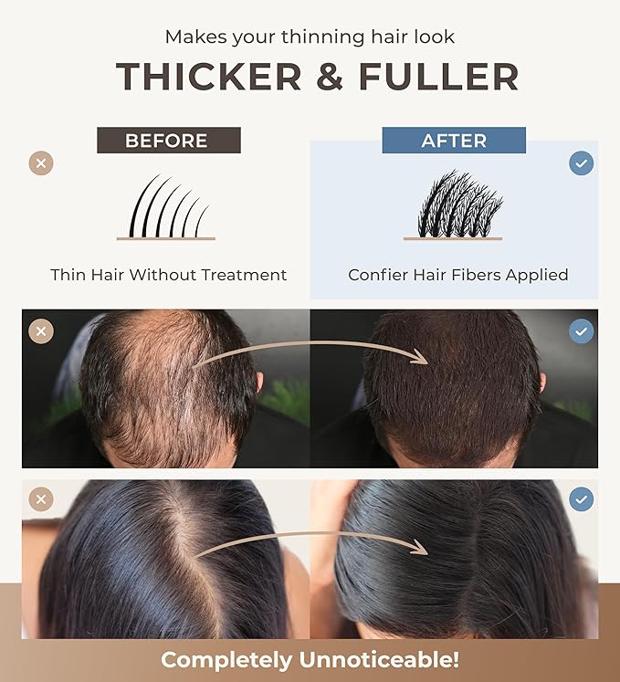 Keratin Hair Fibers for Men & Women - Fill In Fine or Thinning Hair, Instantly Thicker, Fuller Looking Hair (Dark Brown 30g)