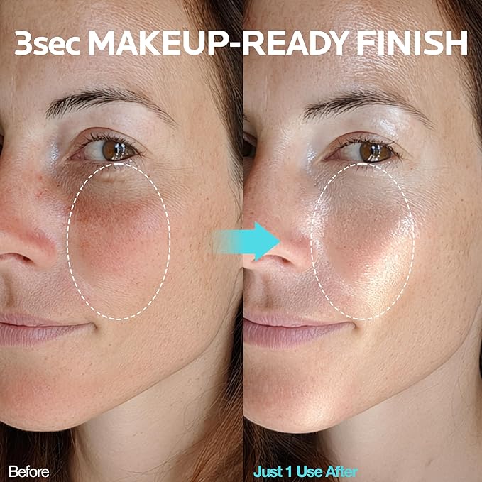 Ice Sorbet Toner Pads | Skin Prep Wipes for Puffiness, Under Eye Bags & Instant Face Lift | Gel Pads for Sunburn Relief & After Sun with 30% Glacier Water & Caffeine | Pack of 2 (120 Count)