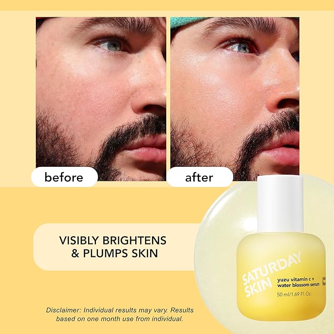 Vitamin C Serum For Face From Yuzu - Brightening Formula With Hyaluronic Acid 7 Peptide Mix And Niacinamide, Deeply Hydrate, Improve Uneven Skin Texture, Vegan, Korean Skin Care (30 ml)