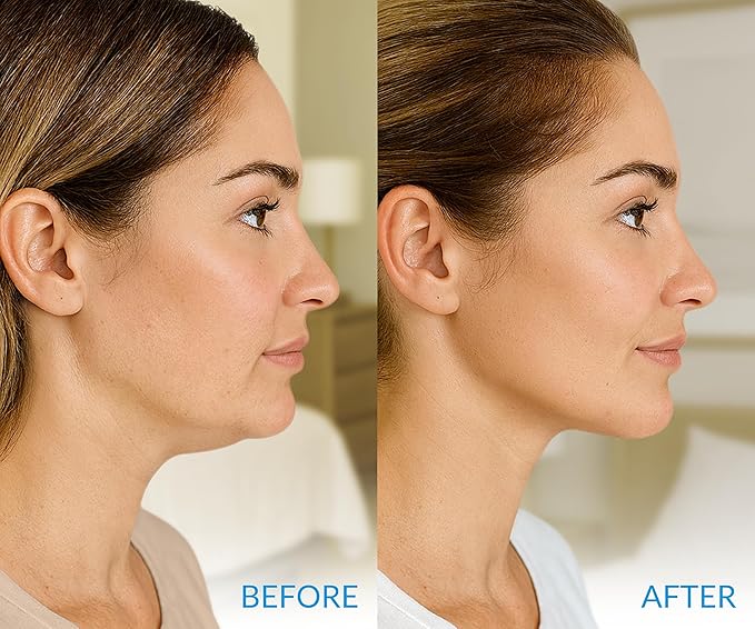 Stylia MaxiLift V-Line Lifting Collagen Face Mask - Advanced Double Chin Reducer - Jawline Shaper - Neck Firming and Tightening Mask with Hyaluronic Acid & Aloe Vera - Chin Strap for Sleeping - 10PC