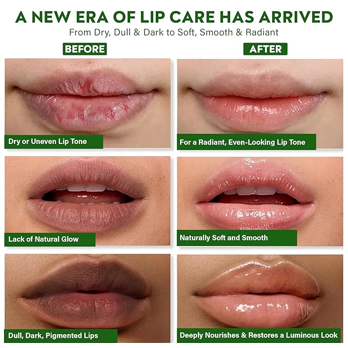 Vegan Lip Brightening Balm – Deeply Hydrating & Moisturizing Lip Care With Turmeric, Licorice, Saffron, Aloe Vera & Vitamin-C - Plant-Based New Improved Ayurvedic Clean Beauty Formula