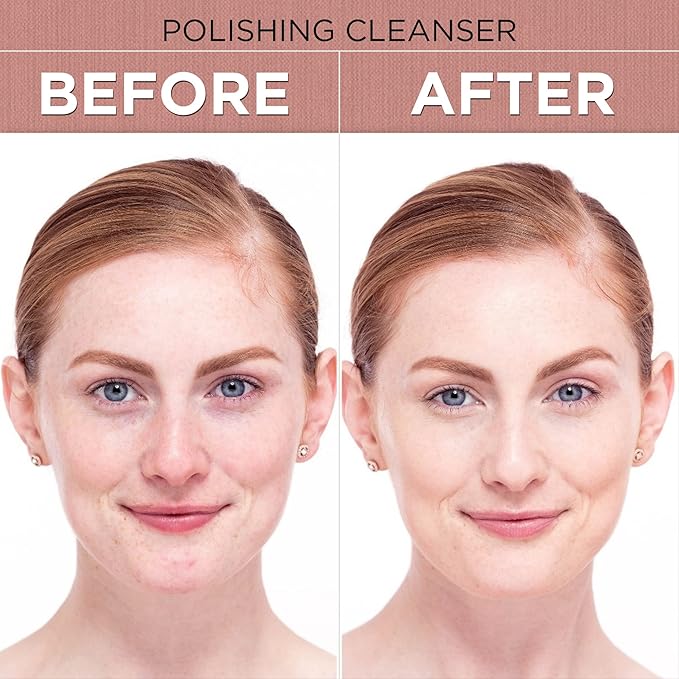 Boto-Derm Rx Polishing Cleanser With Anti Anging FormulaMakes Skin Wrinkle Free and Keeps Skin Hydrated and NourishedUseful for Normal to Dry Skin (150ml)