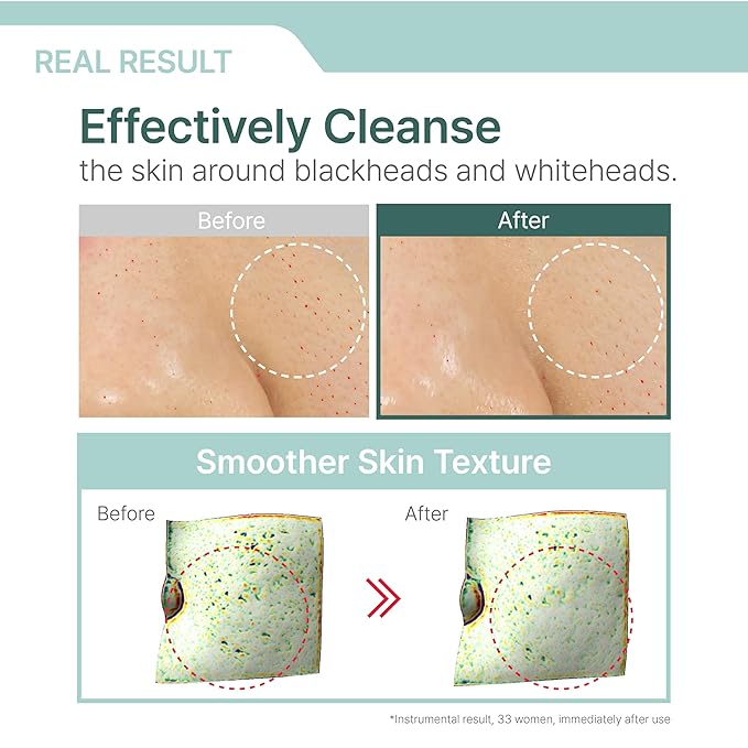 Illiyoon Gentle Deep Cleansing Oil | Lightweight Facial Cleanser with Coconut Oil & AHA/BHA for Makeup, Fragrance-Free, Sebum & Blackhead Removal, Korean Skin Care, 8.45 fl.oz.