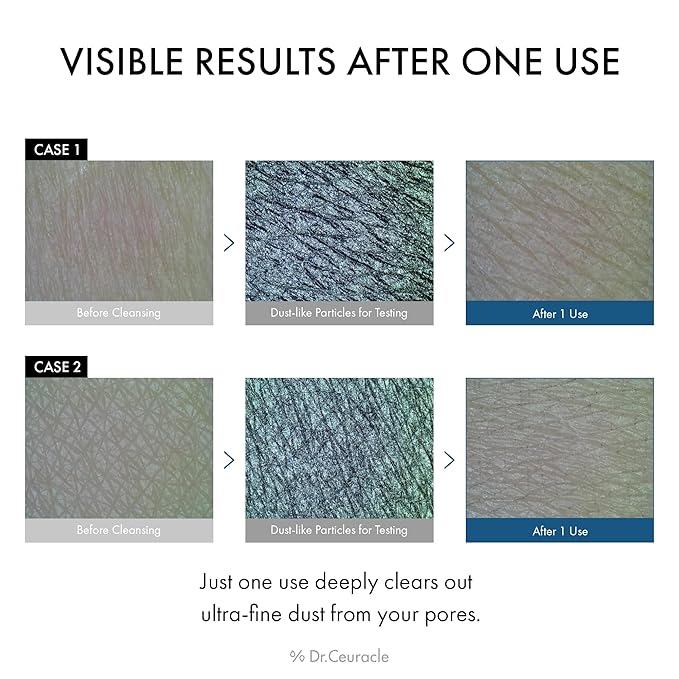 Dr.Ceuracle Pro Balance Enzyme Powder Face Wash - Korean Day and Night Natural Enzyme Powder Face Wash for Deep Pore Cleansing, Sebum Removing, pH Skin Balancing Care (Night Wash)