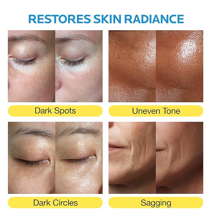 mimmua Dark Spot Ampoule | Korean Clinic Skincare - NAD+ 0.1% & Thioctic Acid 0.01% & Niacinamide 10% | Overnight Treatment for Melasma, Hyperpigmentation, Discoloration, Acne Scars | 15ml /0.33 Fl Oz