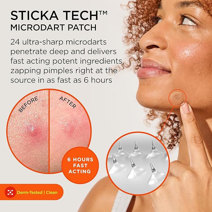 ZitSticka Killa Pimple Patches for Face - World's Most Potent Pimple Patch with Fast-Acting Microdarts - Starts Working within 6 Hours for Deep, Early-Stage Zits - Regular 8 Count with Cleana Swab