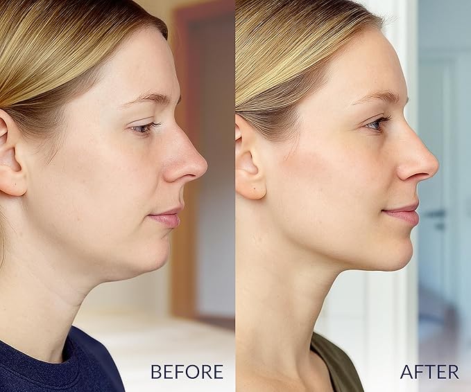 Stylia V Line Lifting Collagen Face Mask - Lift, Firm & Contour Jawline - Double Chin Strap with Hyaluronic Acid & Aloe Vera - Hydrating Neck & Face Tightening Mask - Chin Strap for Sleeping - 20PC