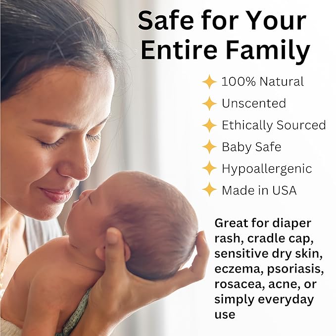 Whipped Tallow Balm & Body Butter (Unscented/Herb-Infused) Grass Fed Tallow Moisturizer for Face, Body & Baby – Organic Olive Oil Infused with Calendula & Frankincense – Handmade Skincare, 2 oz