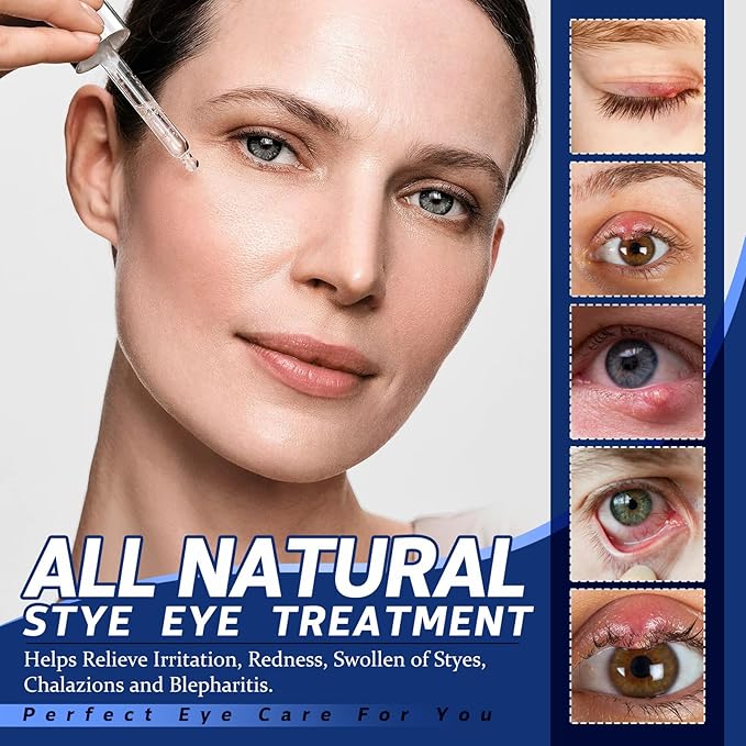 Stye Eye Treatment, Chalazion Treatment Serum, Stye & Blepharitis Remover with Hippophae Rhamnoides Fruit, Helichrysum Angustifolium Flower & Persea Gratissima Oil (1 Fl. OZ (Pack of 1))