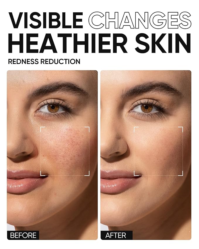 5X Ceramides Moisture Barrier Cream, Hydrating Skin Barrier Repair Face Moisturizer for All Skin Types with Hyaluronic Acid & Centella, Daily Moisturizer, Non-Comedogenic