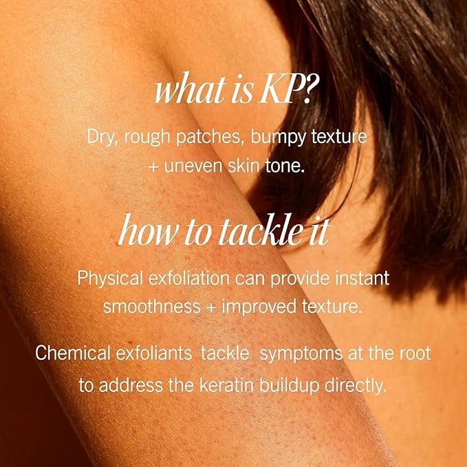 First Aid Beauty KP Bump Eraser Body Scrub Exfoliant for Keratosis Pilaris with 10% AHA – 8 oz