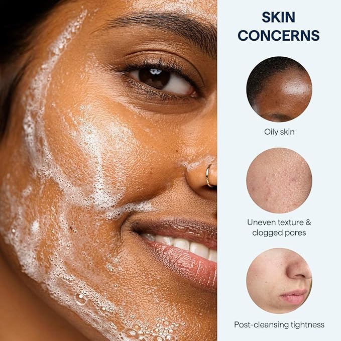 Remedy for Lightweight Cleansing - Gel to Foam Cleanser for Normal to Oily Skin - 0.5% Salicylic Acid, Ceramides, Glycerin, Green Tea - By Dermatologist Dr. Shah, 5 fl. Oz