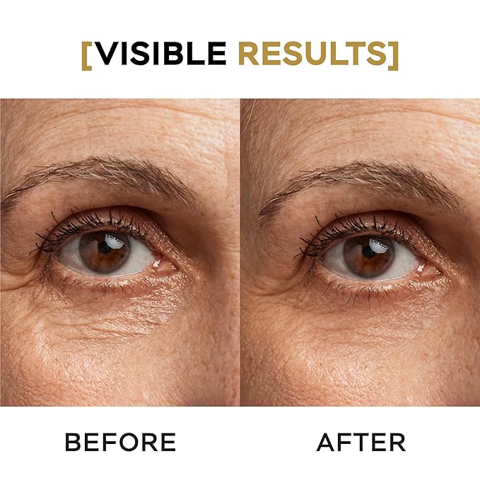 AM/PM Anti-Aging Kit Eye Contour Duo, Deep Hydration Eye Contour Cream with Cotton Stem Cells & Hyaluronic Acid (AM), Eye Contour Anti-Fatigue with Arabic Coffee for Under Eye Lines Protection(PM)