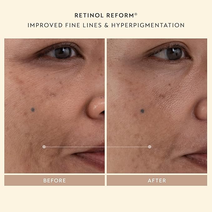 SHANI DARDEN SKINCARE Sculpt & Firm Travel Kit, Facial Sculpting Wand, Attachments, Retinol Reform & Lactic Serums, Peptide Cream & Pep Gel, 7 Items