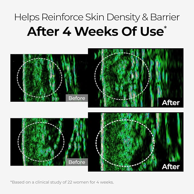 DOMINAS Dark Spot Corrector Cream | Advanced Formula with Niacinamide, TXA, Hexylresorcinol & Bakuchiol to Visibly Reduce Age Spots, Sun Spots & Uneven Tone | Korean Skincare (1.76 oz)