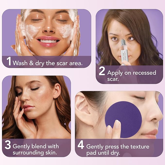 Dermaflage Scar Filler Kit - Light Tan - Deep Scar Cover and Waterproof Concealer for Acne Scars Wrinkles, and Ice Pick Scars Makeup, 1 mo supply