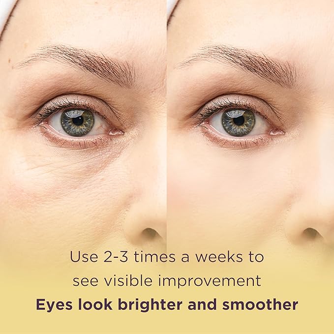 MATKAS Retinol Renewal Gold Under Eye Mask - 20 Pairs, Best Eye Patches for Puffy Eyes and Dark Circles, Collagen Under Eye Patches for Women, Gel Under Eye Masks for Dark Circles and Puffiness