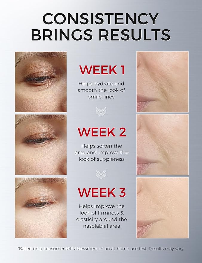 Smile Line & Under Eye Patches – 4-Peptide Anti-Wrinkle Treatment with Collagen, Caffeine & Niacinamide – Firming, Hydrating, Brightening Face Pads for Laugh Lines, Eye Bags, 10 Pairs