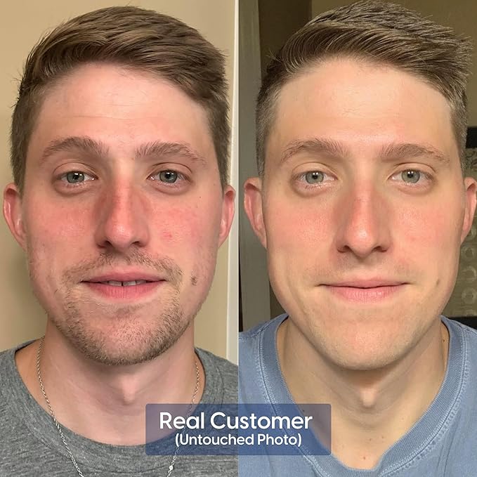 Strive Apex Skin Care Set - Advanced Anti Aging - Fragrance Free, All Skin Types, Fights Dark Circles Dull Skin - Peptides, Retinal, Vitamin C, Niacinamide (Face Wash, Scrub, Moisturizer, Serum)