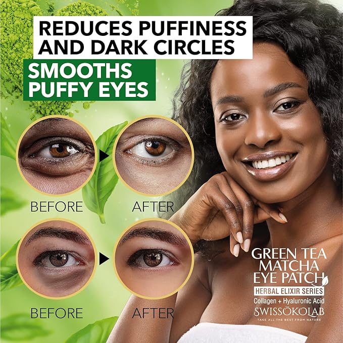 SWISSÖKOLAB Under Eye Patches For Puffy Eyes 24k Gold Eye Mask Dark Circles And Puffiness Collagen Eye Gel Pads Moisturizing & Reducing Wrinkles Anti-Aging Hyaluronic Acid (Green Tea)