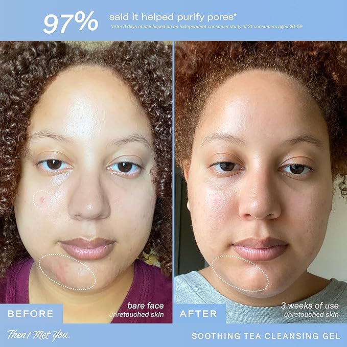 Then I Met You Soothing Tea Cleansing Gel, Hydrating Water-Based Face Cleanser with Fermented Rice Water & Green Tea, Vegan & Clean Skincare, 3.38 oz