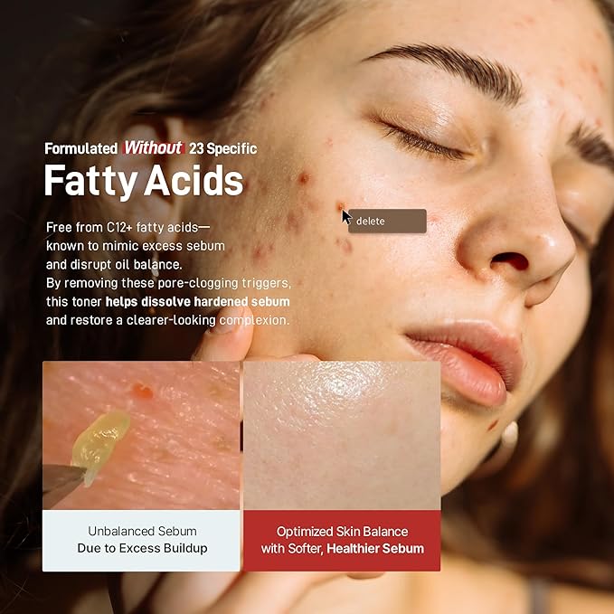 Zeroca 86 Korean Toner for Acne-Prone & Oily Skin – Fast Calming & Soothing for Breakout Relief – Calms Redness & Supports Clear Skin (6.76 fl.oz. 200ml)