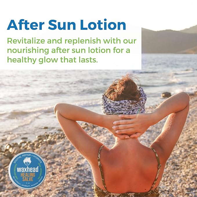 Waxhead Aftersun Body Butter for Sunburn Relief - Also great Tattoo Balm, Eczema Cream for Kids Adults, After Sun Lotion, Sunburn Treatment, Healing Salve