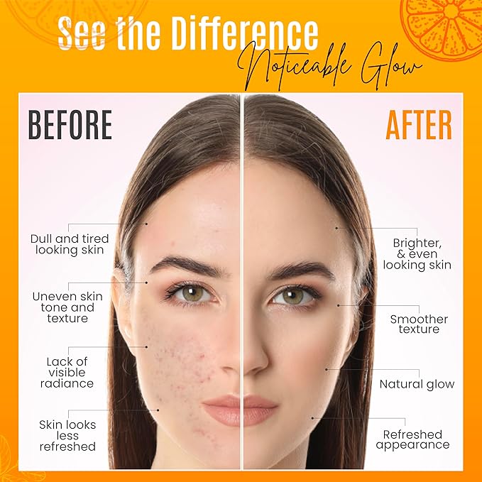 Vitamin C Serum with Pure Retinol, Hyaluronic Acid, & Organic Anti-Aging Formula - 4 Fl Oz