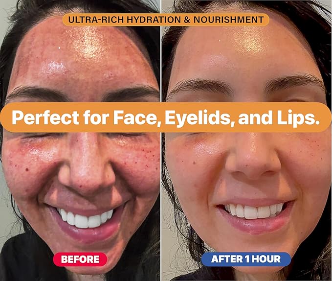 Eczema Cream for Adults & Kids – Hypoallergenic Barrier Repair Moisturizer, Clinically Proven (3 Studies), Fragrance-Free, Dermatologist Tested, Face & Body Hydration, NEA Accepted, USA Made