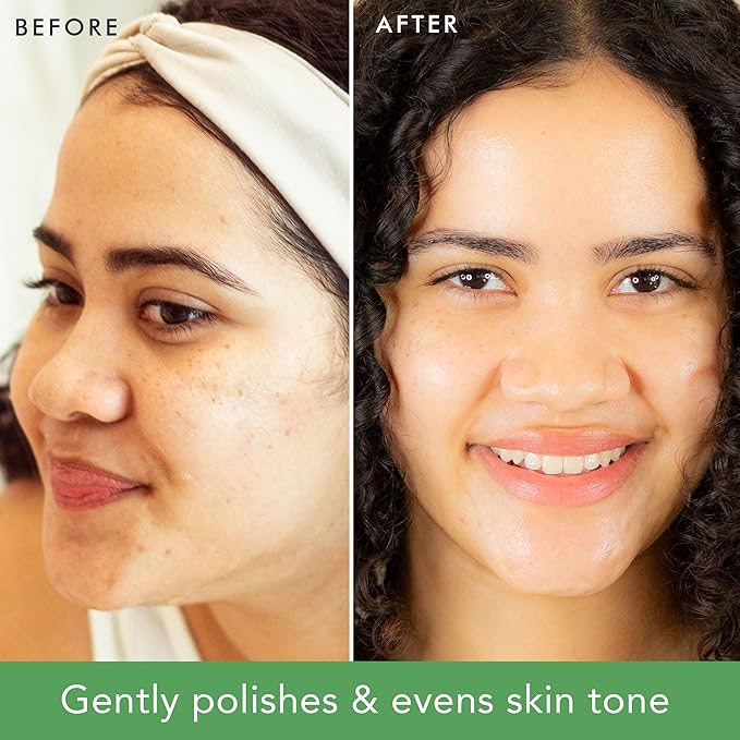 Facial Scrub Exfoliator - USA Made with Natural & Organic Ingredients, Gentle Exfoliating Face Wash for Sensitive & Acne Prone Skin, Microdermabrasion Scrub, Removes Dead Skin Cells (2 Fl Oz)