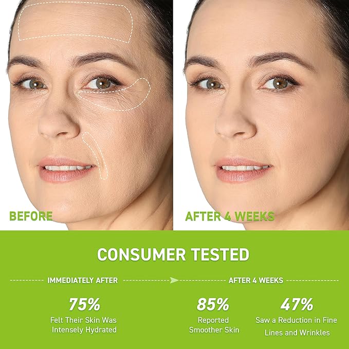 Anti-Wrinkle Retinol Serum for Face: Anti Aging Firming Skin Treatment with Hyaluronic Acid & Collagen - Deep Hydration Facial Care for Women Over 30，Daily & Night Use, 1.0 fl.oz