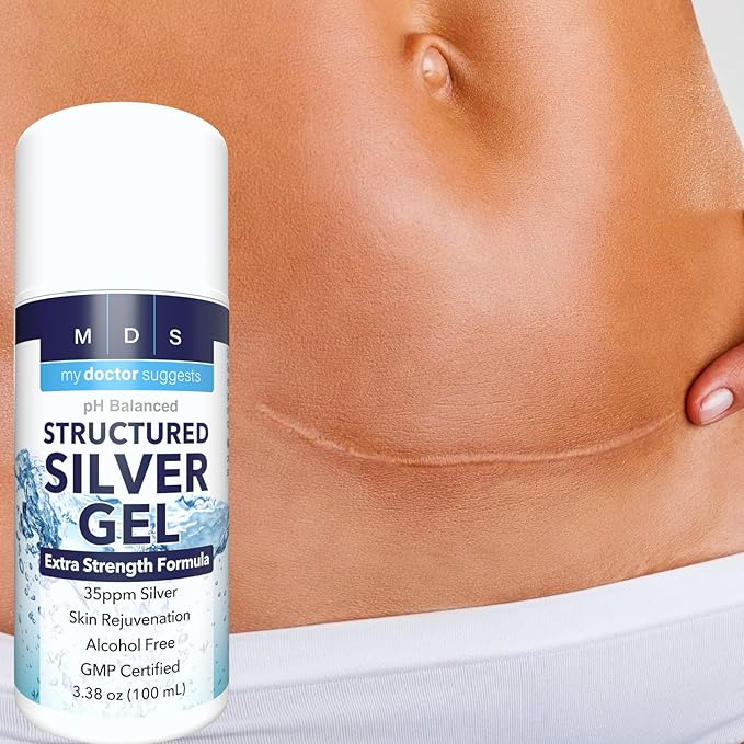 Structured Colloidal Silver Gel Extra Strength - Topical Cooling - pH Balanced 35ppm Structured Silver Provides Soothing Relief of Burns & Skin Irritations