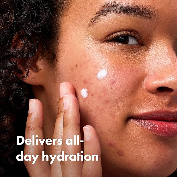 HERO COSMETICS Rescue Balm Original-New Formula The Post-Blemish Cream to Boost Hydration and Improve the Look of Post-Blemish Marks. Derm-Tested. New Formula. Won’t Clog Pores. 15mL