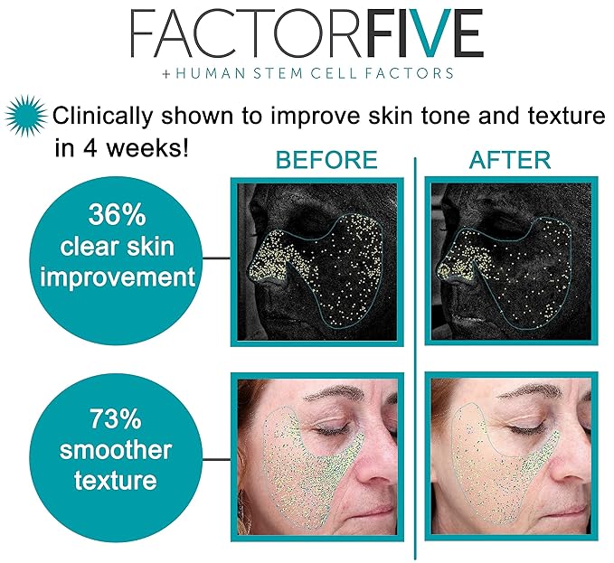 Age Defying Cream with Stem Cell Growth Factors for Anti-Wrinkle, Collagen Boost, and Acne Scarring Repair, Large Size, 1fl oz/30ml