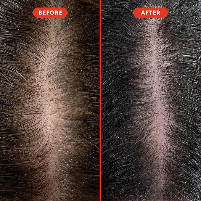 Fable and Mane Hair Oil - HoliRoots Strengthening Serum for Damaged, Frizzy Hair with Amla, Castor Oil for Hair Health - 3.4FL oz